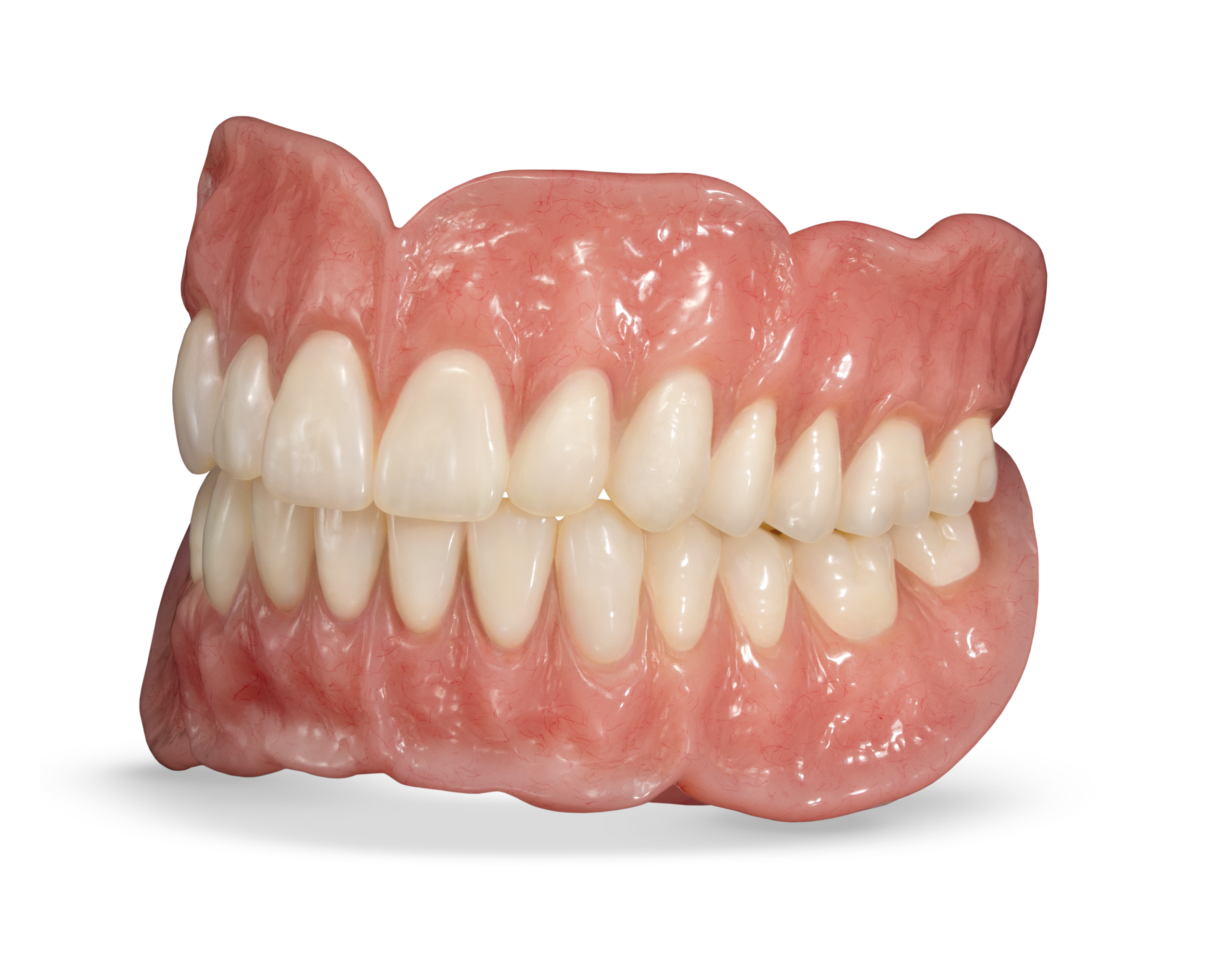 Complete Denture